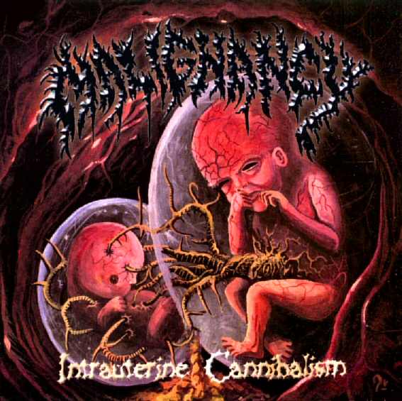 MALIGNANCY - Intrauterine Cannibalism - CD